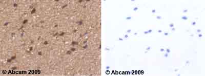 Immunohistochemistry (Formalin/PFA-fixed paraffin-embedded sections) - Anti-SerpinB2/PAI-2 antibody (AB47742)