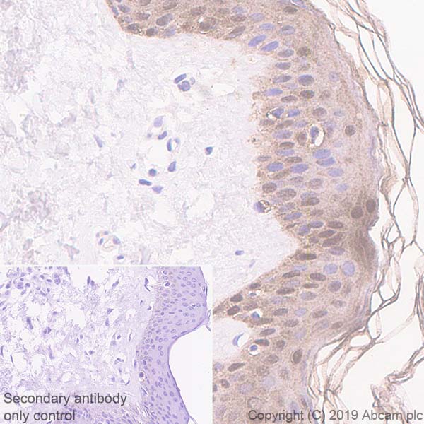 Immunohistochemistry (Formalin/PFA-fixed paraffin-embedded sections) - Anti-SerpinB2/PAI-2 antibody [EPR22924-56] (AB267463), expandable thumbnail