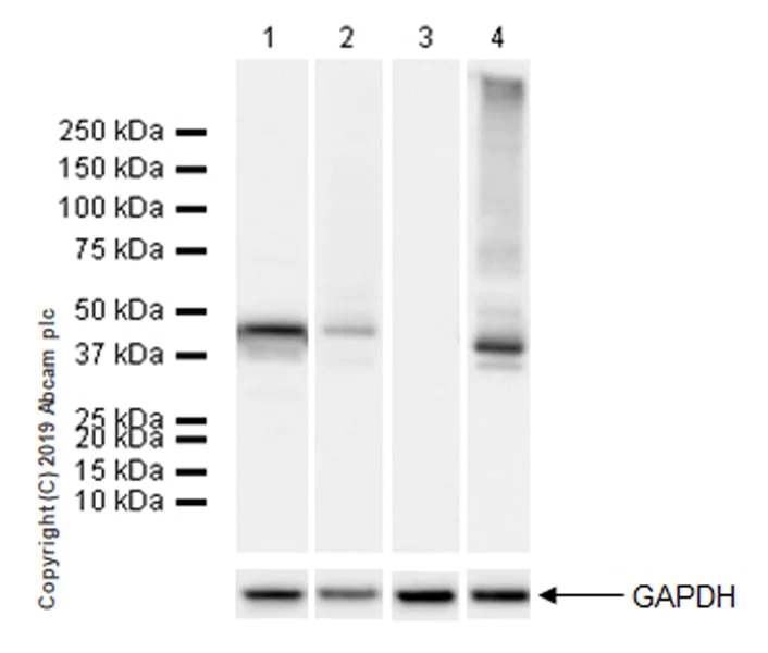 Western blot - Anti-SerpinB2/PAI-2 antibody [EPR22924-56] (AB267463)