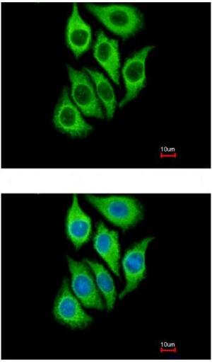 Immunocytochemistry/ Immunofluorescence - Anti-SerpinB3/SCCA antibody (ab154971), expandable thumbnail