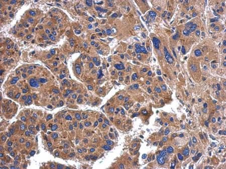 Immunohistochemistry (Formalin/PFA-fixed paraffin-embedded sections) - Anti-SerpinB3/SCCA antibody (AB154971), expandable thumbnail
