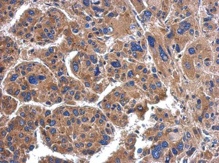 Immunohistochemistry (Formalin/PFA-fixed paraffin-embedded sections) - Anti-SerpinB3/SCCA antibody (AB154971)