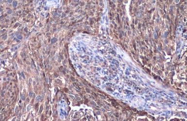 Immunohistochemistry (Formalin/PFA-fixed paraffin-embedded sections) - Anti-SerpinB3/SCCA antibody (AB154971), expandable thumbnail