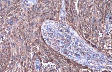 Immunohistochemistry (Formalin/PFA-fixed paraffin-embedded sections) - Anti-SerpinB3/SCCA antibody (AB154971)
