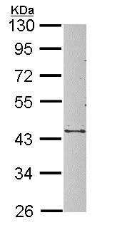 Western blot - Anti-SerpinB3/SCCA antibody (AB154971)
