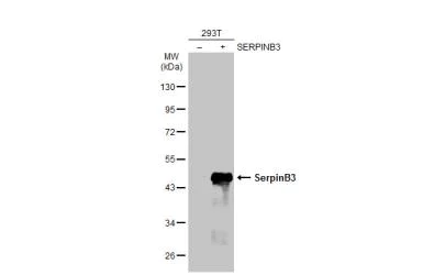 Western blot - Anti-SerpinB3/SCCA antibody (AB154971)