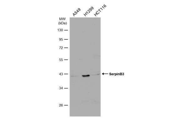 Western blot - Anti-SerpinB3/SCCA antibody (AB154971)