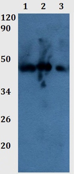 Western blot - Anti-SerpinB3/SCCA antibody (AB201081)