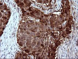 Immunohistochemistry (Formalin/PFA-fixed paraffin-embedded sections) - Anti-SerpinB3/SCCA antibody [OTI1A5] (AB180396)