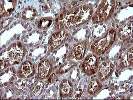 Immunohistochemistry (Formalin/PFA-fixed paraffin-embedded sections) - Anti-SerpinB3/SCCA antibody [OTI1A5] (AB180396)