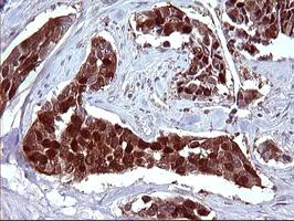 Immunohistochemistry (Formalin/PFA-fixed paraffin-embedded sections) - Anti-SerpinB3/SCCA antibody [OTI1A5] (AB180396)