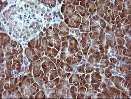 Immunohistochemistry (Formalin/PFA-fixed paraffin-embedded sections) - Anti-SerpinB3/SCCA antibody [OTI1A5] (AB180396)