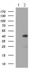 Western blot - Anti-SerpinB3/SCCA antibody [OTI1A5] (AB180396)