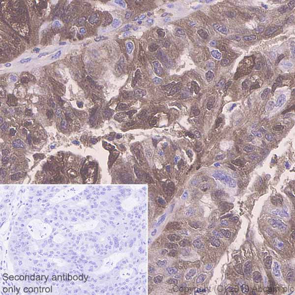 Immunohistochemistry (Formalin/PFA-fixed paraffin-embedded sections) - Anti-SerpinB3/SCCA + SerpinB4/SCCA-2 antibody [EPR22455-57] - BSA and Azide free (AB255272)