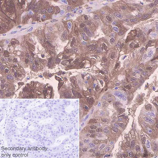 Immunohistochemistry (Formalin/PFA-fixed paraffin-embedded sections) - Anti-SerpinB3/SCCA + SerpinB4/SCCA-2 antibody [EPR22455-57] - BSA and Azide free (AB255272)