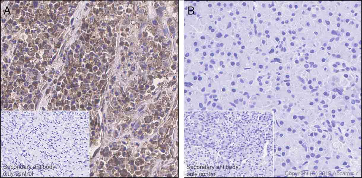 Immunohistochemistry (Formalin/PFA-fixed paraffin-embedded sections) - Anti-SerpinB3/SCCA + SerpinB4/SCCA-2 antibody [EPR22455-57] - BSA and Azide free (AB255272)