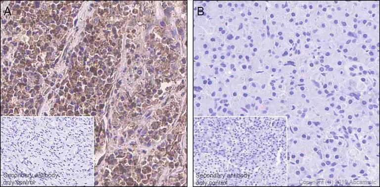 Immunohistochemistry (Formalin/PFA-fixed paraffin-embedded sections) - Anti-SerpinB3/SCCA + SerpinB4/SCCA-2 antibody [EPR22455-57] - BSA and Azide free (AB255272)