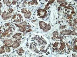 Immunohistochemistry (Formalin/PFA-fixed paraffin-embedded sections) - Anti-SerpinB4/SCCA-2 antibody (AB197096)