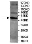 Western blot - Anti-SerpinB4/SCCA-2 antibody (AB197096)