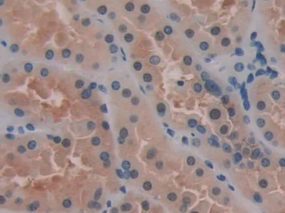 Immunohistochemistry (Formalin/PFA-fixed paraffin-embedded sections) - Anti-SerpinB6/CAP antibody (AB233229)