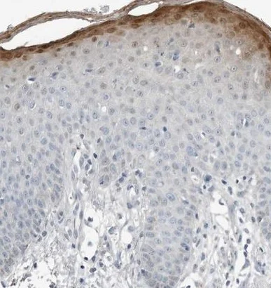 Immunohistochemistry (Formalin/PFA-fixed paraffin-embedded sections) - Anti-SerpinB7 antibody (AB224456)