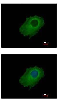 Immunocytochemistry/ Immunofluorescence - Anti-SERPINE2/PN-1 antibody (AB154591)