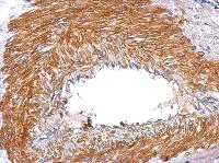 Immunohistochemistry (Formalin/PFA-fixed paraffin-embedded sections) - Anti-SERPINE2/PN-1 antibody (AB154591)