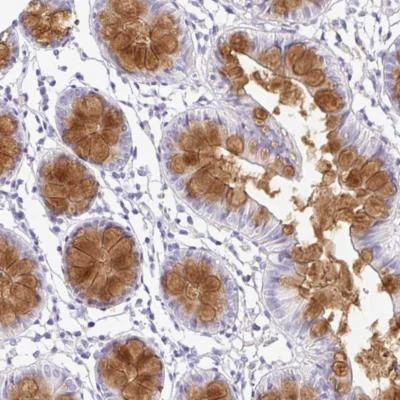 Immunohistochemistry (Formalin/PFA-fixed paraffin-embedded sections) - Anti-SERPINE3 antibody (AB188155)