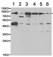 Western blot - Anti-SERPING1 antibody (AB180774), expandable thumbnail