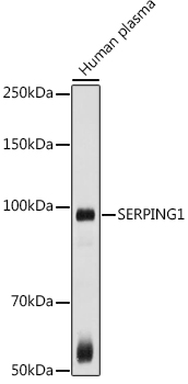 Western blot - Anti-SERPING1 antibody (AB180774)