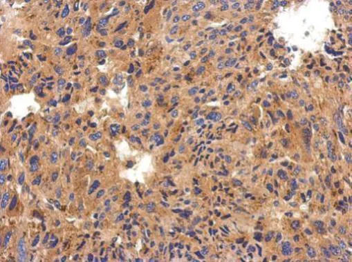 Immunohistochemistry (Formalin/PFA-fixed paraffin-embedded sections) - Anti-SERPING1 antibody (AB229209)