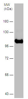 Western blot - Anti-SERPING1 antibody (AB229209), expandable thumbnail