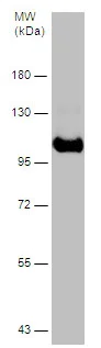 Western blot - Anti-SERPING1 antibody (AB229209)