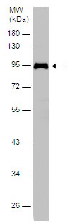Western blot - Anti-SERPING1 antibody (AB229209), expandable thumbnail
