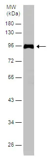 Western blot - Anti-SERPING1 antibody (AB229209)