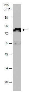 Western blot - Anti-SERPING1 antibody (AB229209), expandable thumbnail
