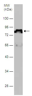 Western blot - Anti-SERPING1 antibody (AB229209)