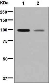 Western blot - Anti-SERPING1 antibody [EPR8015] (AB134918)
