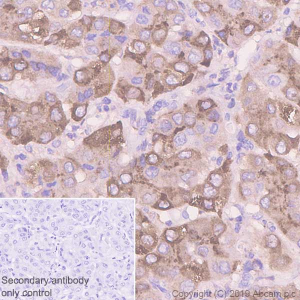 Immunohistochemistry (Formalin/PFA-fixed paraffin-embedded sections) - Anti-Serum Amyloid A antibody [EP11592-92] (AB190802)