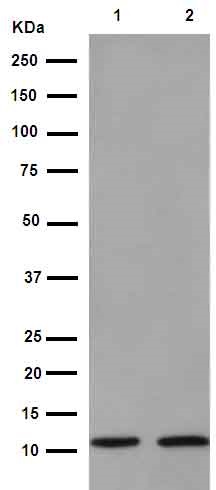 Western blot - Anti-Serum Amyloid A antibody [EPR11592-129] (AB190801)