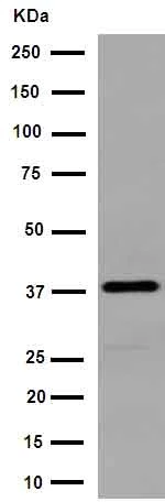 Western blot - Anti-Serum Amyloid A antibody [EPR11592-129] - BSA and Azide free (AB251043)