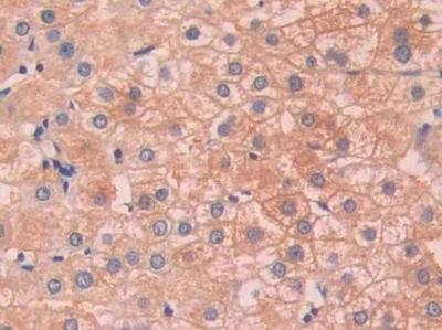 Immunohistochemistry (Formalin/PFA-fixed paraffin-embedded sections) - Anti-Serum Amyloid P/SAP antibody (AB233265)