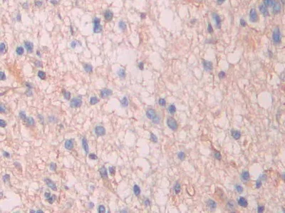 Immunohistochemistry (Formalin/PFA-fixed paraffin-embedded sections) - Anti-Serum Amyloid P/SAP antibody (AB233265)