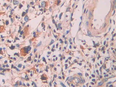 Immunohistochemistry (Formalin/PFA-fixed paraffin-embedded sections) - Anti-Serum Amyloid P/SAP antibody (AB233265)