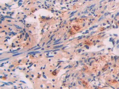 Immunohistochemistry (Formalin/PFA-fixed paraffin-embedded sections) - Anti-Serum Amyloid P/SAP antibody (AB233265)