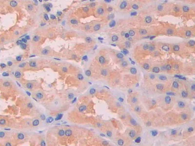 Immunohistochemistry (Formalin/PFA-fixed paraffin-embedded sections) - Anti-Serum Amyloid P/SAP antibody (AB233265)