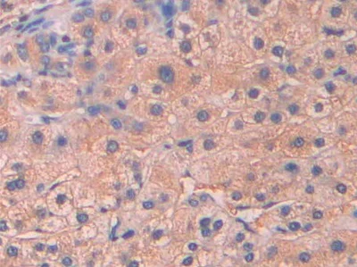 Immunohistochemistry (Formalin/PFA-fixed paraffin-embedded sections) - Anti-Serum Amyloid P/SAP antibody (AB233265)