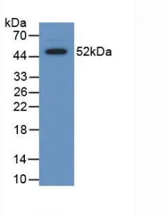 Western blot - Anti-Serum Amyloid P/SAP antibody (AB233265)