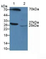 Western blot - Anti-Serum Amyloid P/SAP antibody (AB233265)