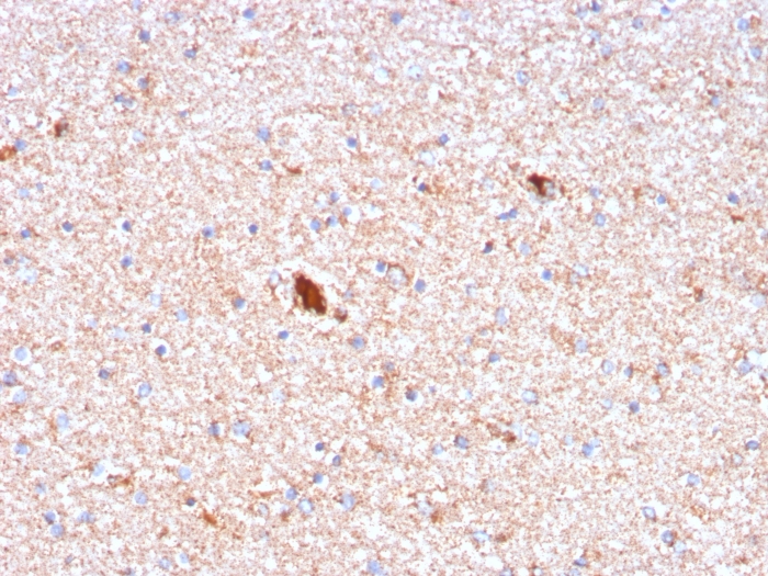 Immunohistochemistry (Formalin/PFA-fixed paraffin-embedded sections) - Anti-Serum Amyloid P/SAP antibody [APCS/3240] (AB268071)